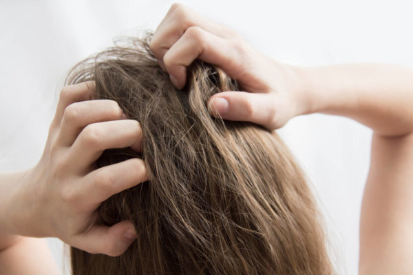 冬天頭皮癢怎麼辦？選對保養方式、洗髮精解決煩惱！